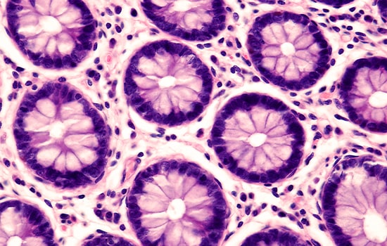 Epithelial stem cells